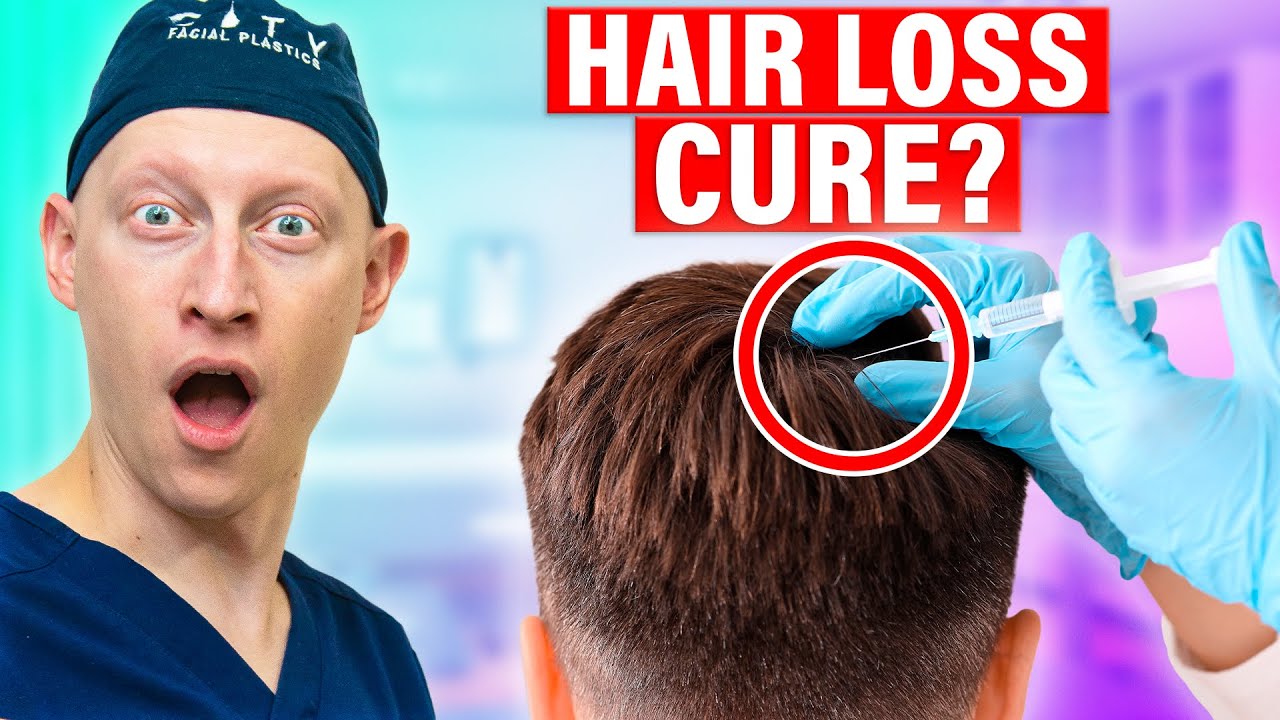 PRP treatments for hair loss