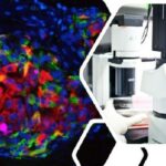 Kadismastem beta cells under microscope imaging