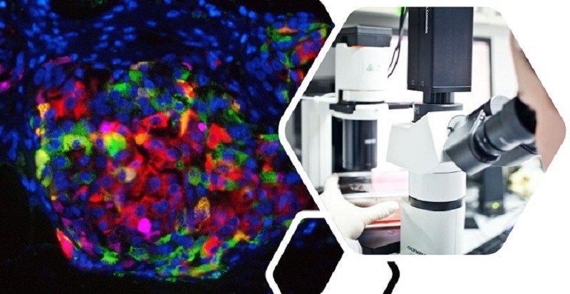 Kadismastem beta cells under microscope imaging