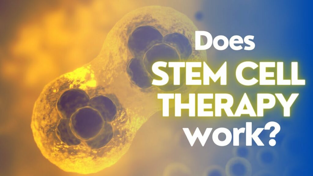 Stem cell therapy- Great scam or a miraculous treatment