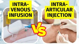 Intravenous (IV) vs Intra-articular Stem Cell Therapy for Knee Arthritis - Dr Jeffrey Peng