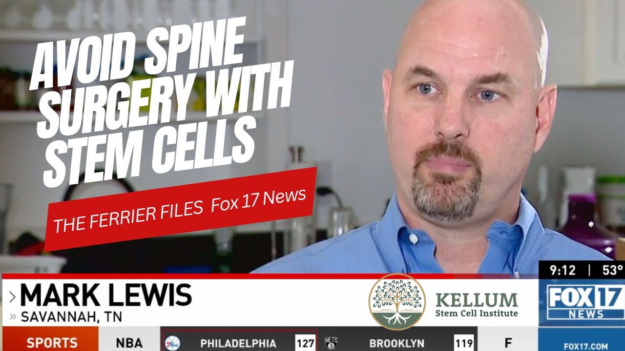 Mark Lewis Stem Cell Therapy Results - Kellum Stem Cell Institute