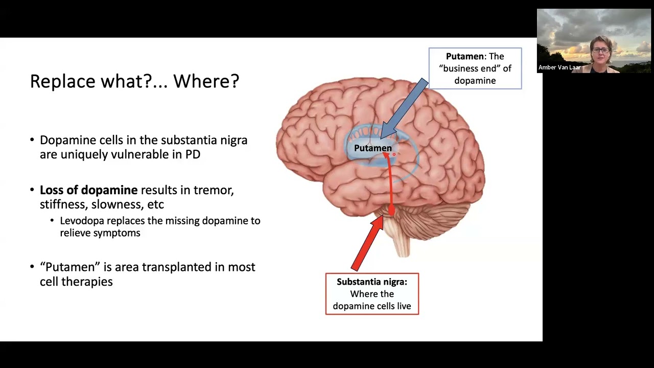 The Current State of Stem Cell & Gene Therapies for Parkinson’s Disease Webinar