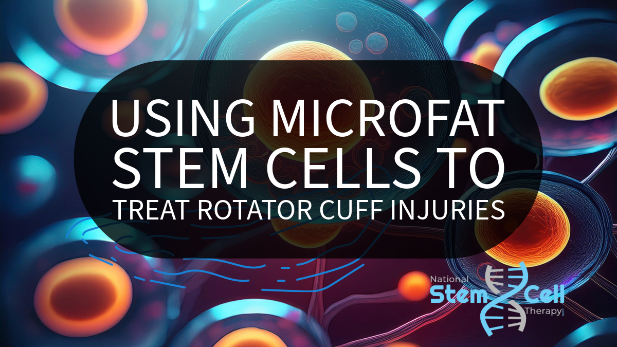 using microfat stem cells to treat rotator cuff injuries