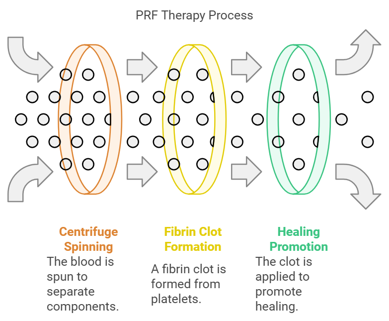 PRF Therapy Process