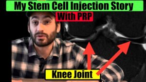 Affordable Stem Cell and PRP Therapy for Knee Repair