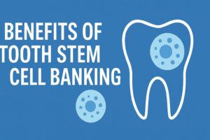 Tooth stem cell banking benefits