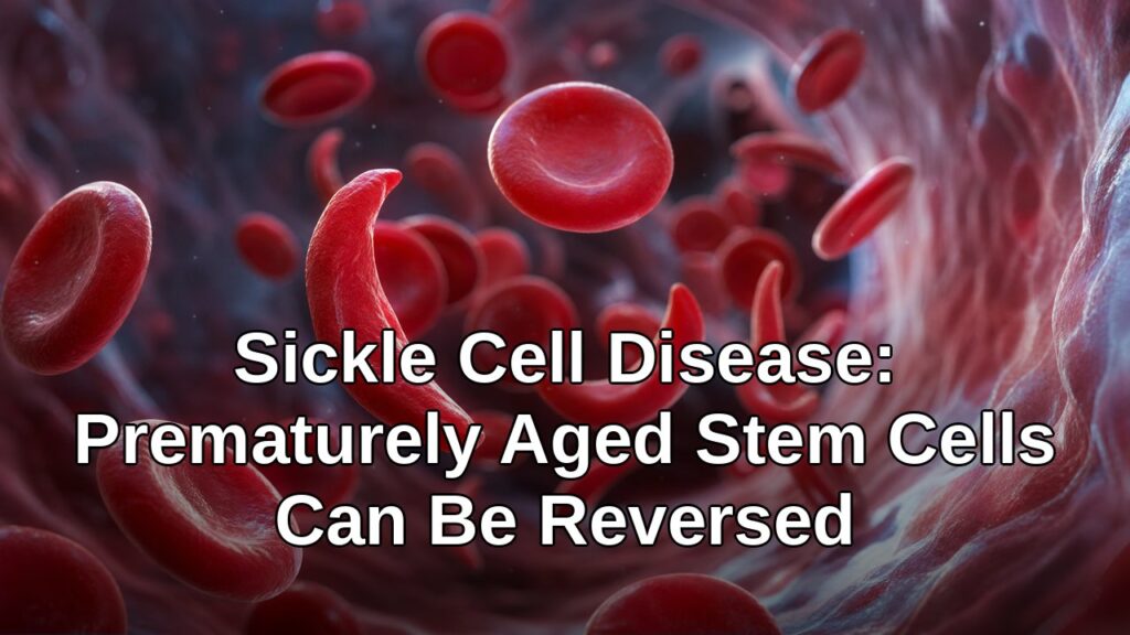 Sickle and healthy red blood cells in bloodstream - sickle cell stem cell aging reversed